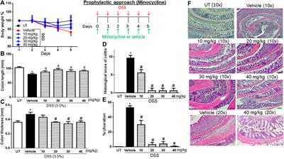 Minocycline synergizes with corticosteroids in reducing colitis severity in mice via the modulation of pro-inflammatory molecules